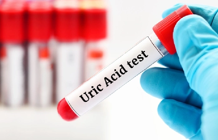 Uric of Manage Blood Sugar