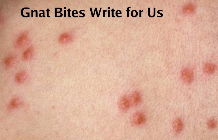 Gnat Bites Write for Us