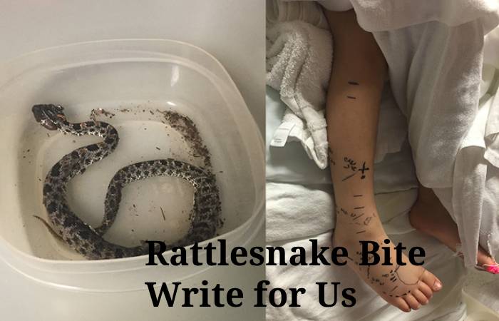 Rattlesnake Bite Write for Us