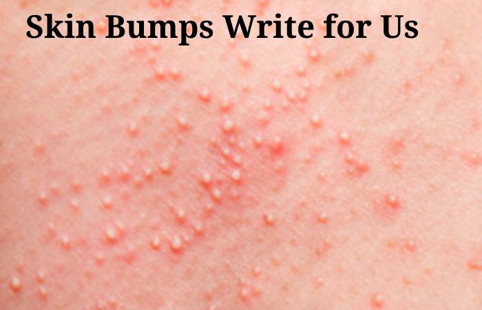 Skin Bumps Write for Us