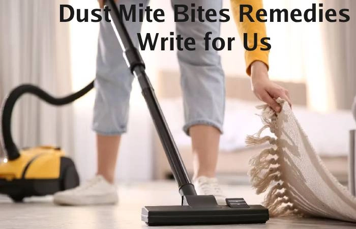 Dust Mite Bites Remedies Write for Us