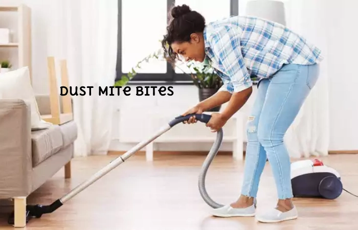 Dust Mite Bites 