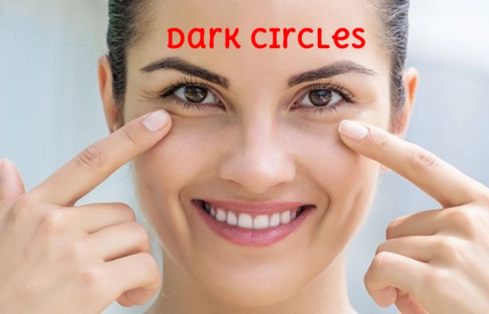 Dark Circles