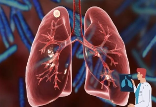 common infections