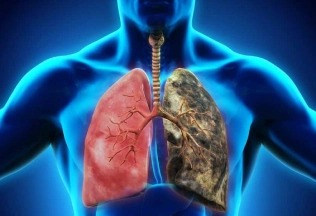 respiratory diseases